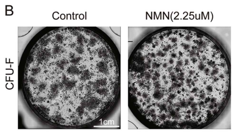NMNは骨髄幹細胞を刺激し、より多い骨と少ない脂肪を形作る